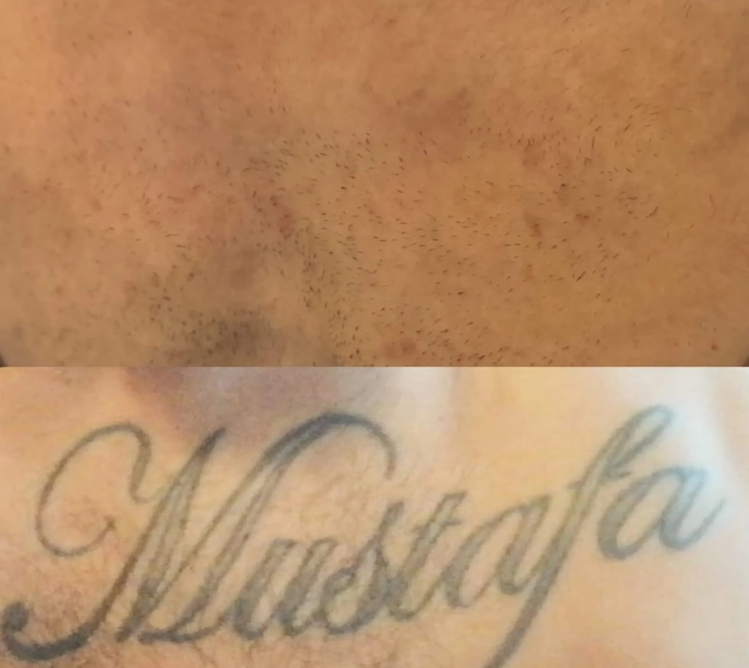 can Vaseline ruin tattoo healing