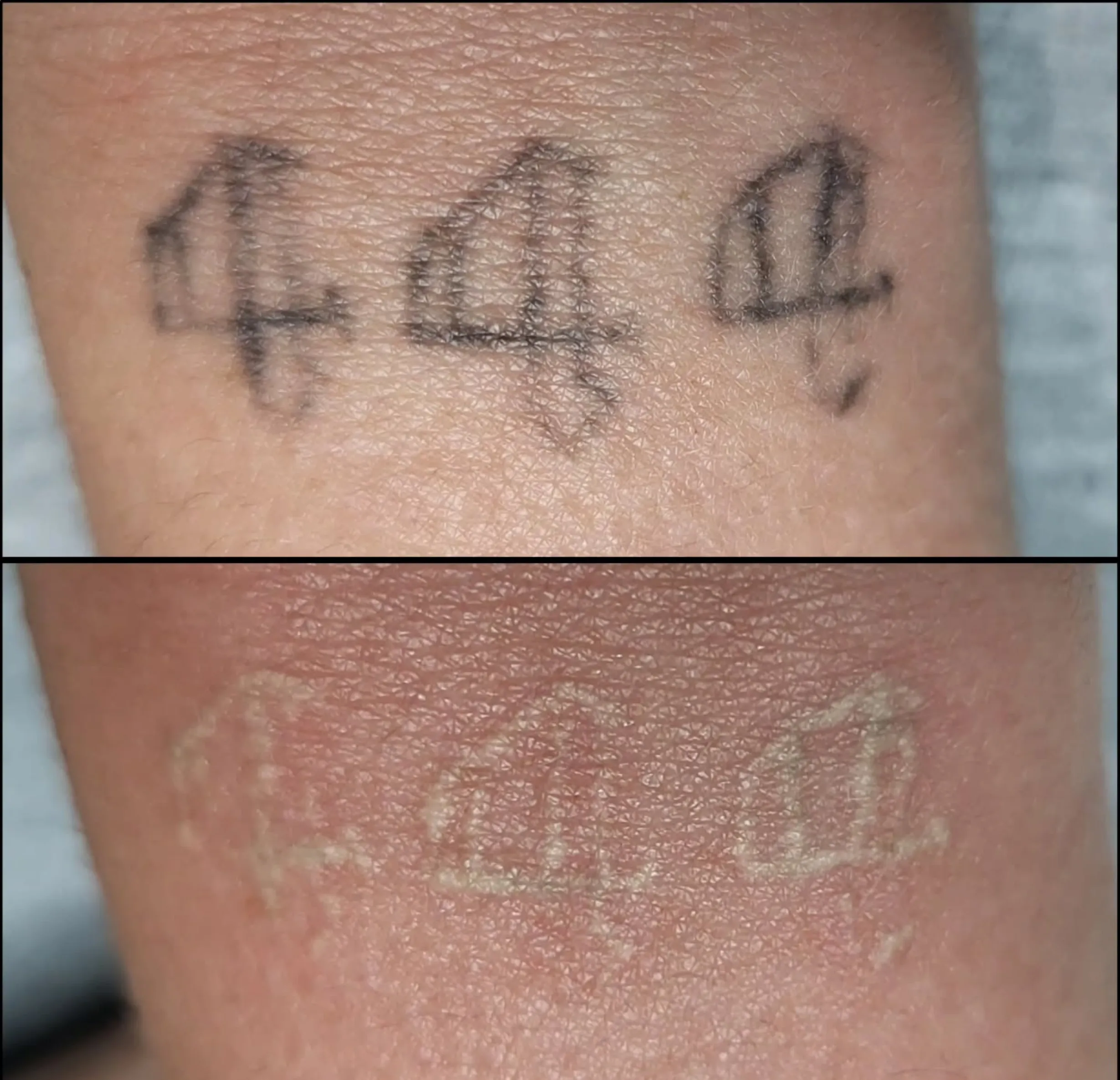 what fades a tattoo naturally