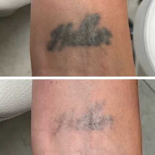Does Vaseline Fade Tattoos