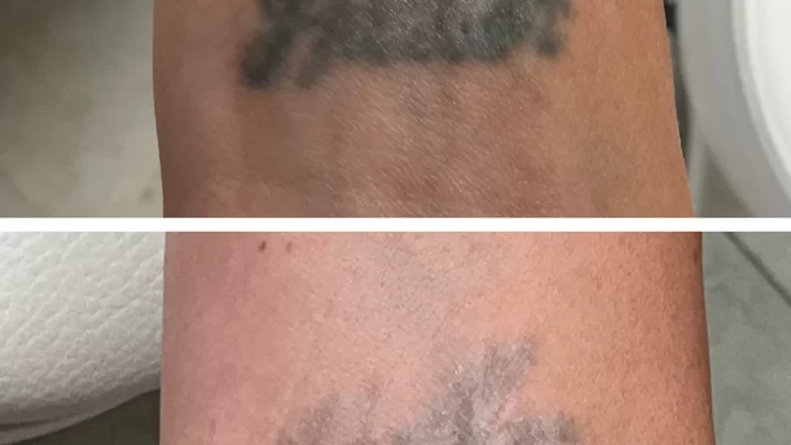 Does Vaseline Fade Tattoos