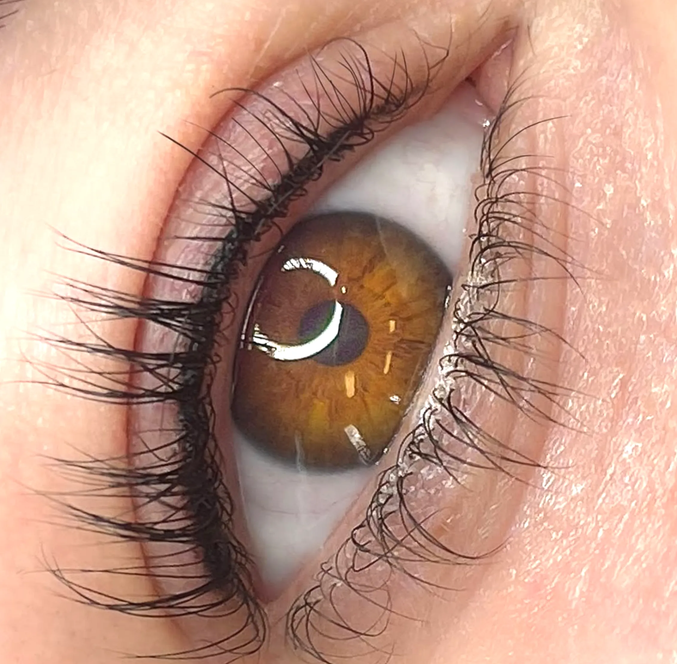 allergic reaction eyeliner tattoo