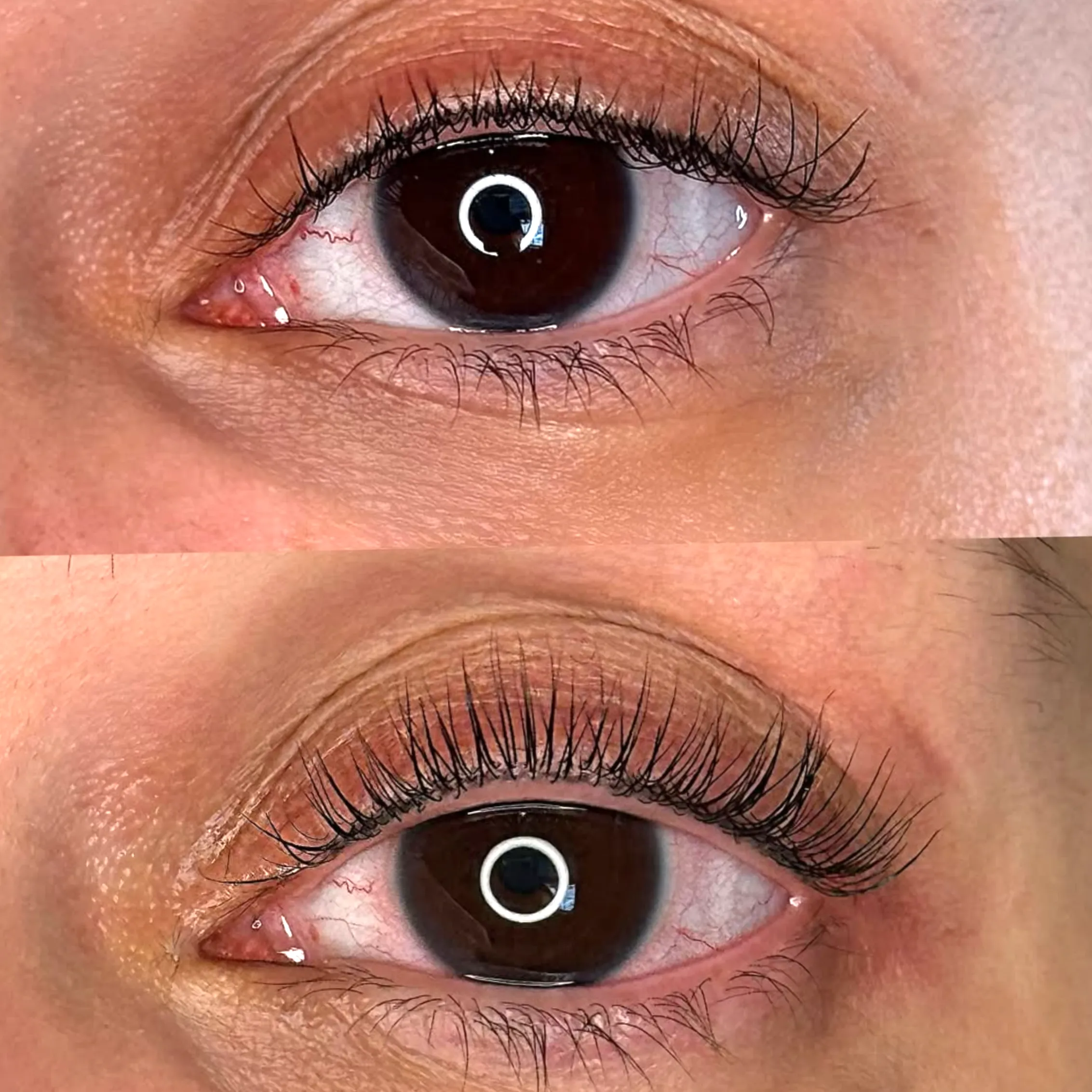 eyeliner tattoo side effects